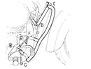Honda VT 750 C2 [1997-2001] - Motorvédő-2